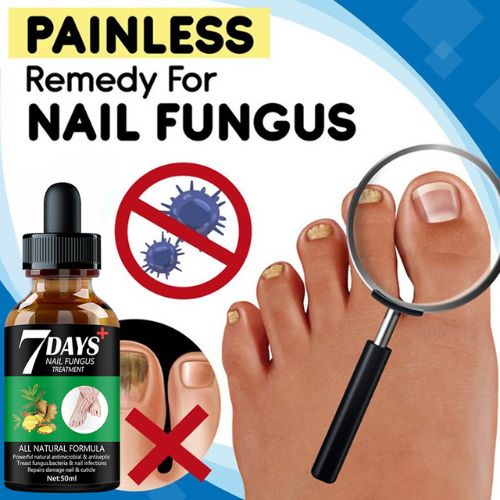 Sérum pour le traitement des mycoses des ongles des pieds
