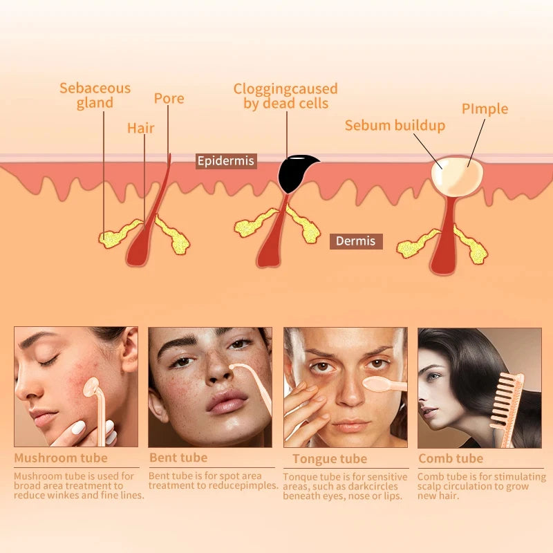 Baguette d'électrothérapie haute fréquence 4 en 1